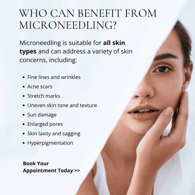 Package of 3 Microneedling at PAMPERED BY ARI in Danvers, MA